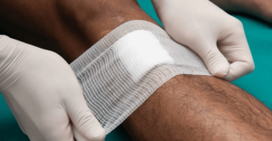 Managing Pain and Discomfort in Open Wound Healing