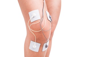 nerve conduction study